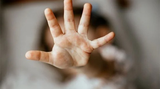 2 yaşındaki çocuğa cinsel istismar: Hayati tehlikesi var