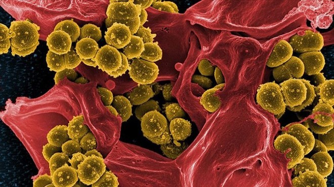 Bakterilerin  ölüm çığlığı  diğer bakterileri uyarıyor