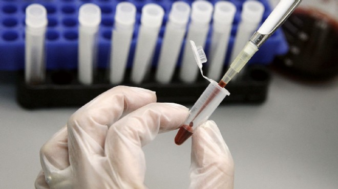 Bilim Kurulu Üyesi Şener: Sessiz bir  HIV pandemisi  var!
