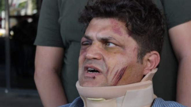 Doktora sopalı saldırıya 5 yıl hapis!