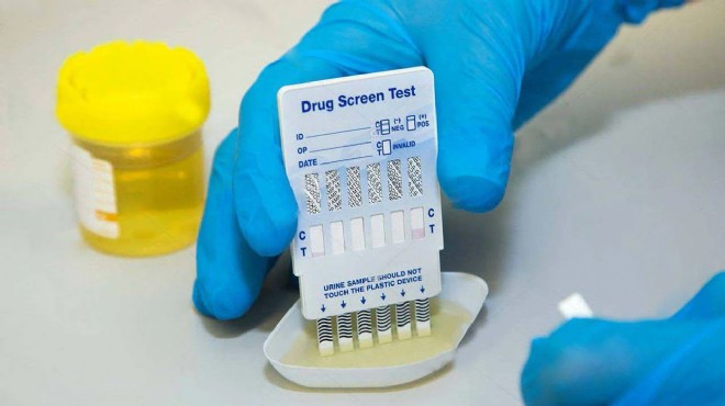 İşe alımda 'uyuşturucu testi' dönemi: Talep 7 kat arttı