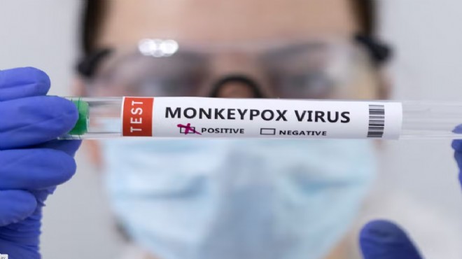 İspanya da maymun çiçeği virüsünden ilk ölüm