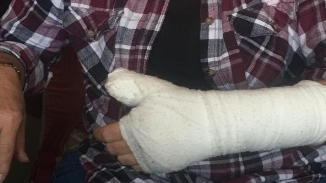 İzmir deki hastanede skandal: Pansumana gitti, parmağından oldu!