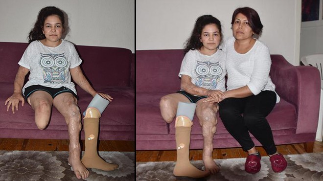Menenjit yüzünden bacağını kaybeden Melis in yardım çığlığı!