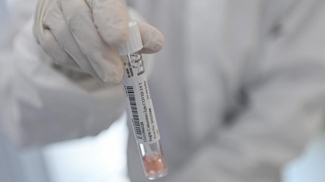 Oxford Üniversitesi: Aşı eylülde hazır olabilir