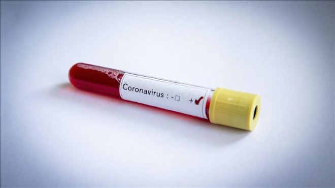 Türkiye de corona virüs ten can kaybı 131 e çıktı