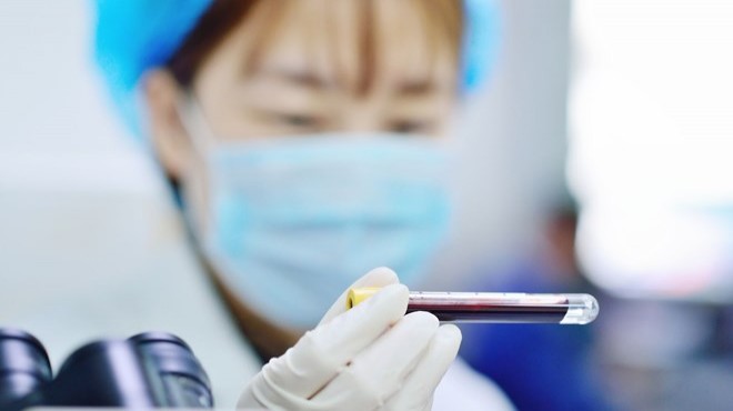 'Gizemli virüs' Çin'de 17 can aldı
