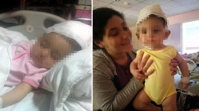 Ablasının annesine fırlattığı çatal 9 aylık bebeğin başına saplandı!