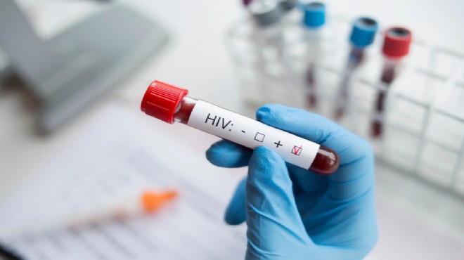 Büyükşehir'den halk sağlığında yeni adım: Ücretsiz HIV testi dönemi