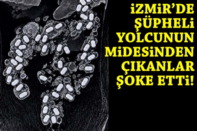 Havalimanında şüpheli yolcunun midesinden çıkanlar şoke etti!