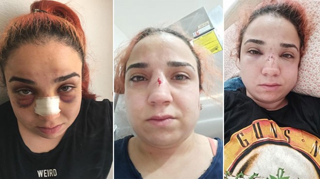Kadın çalışandan patronuna 'süpürgeyle dövdü' suçlaması