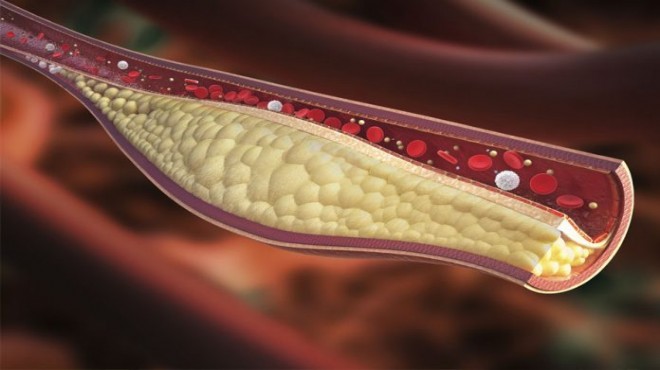 Kolesterolün iyisi de vardır kötüsü de!