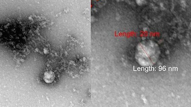 Mutant koronavirüs ilk kez görüntülendi