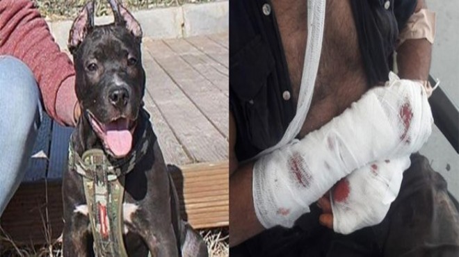 Pitbull sahibine saldırdı, polis vurarak kurtardı