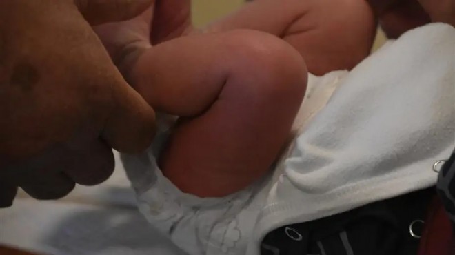 Sünnet edilen 27 günlük bebek öldü