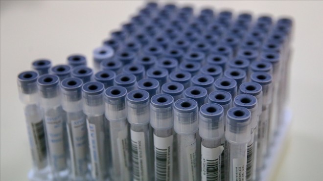 Çamlı'dan 'PCR kararı' yorumu: 'Pandemiyle mücadeleyi bıraktık' demek gibi!