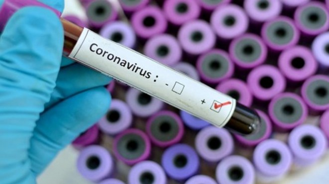 Türkiye de corona virüsten can kaybı 214 oldu