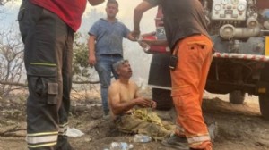 'Yanıyorum' diye feryat etmişti: Yoğun bakımda!