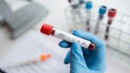 Büyükşehir'den halk sağlığında yeni adım: Ücretsiz HIV testi dönemi