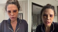 Didem Ceran estetik ameliyatını anlattı