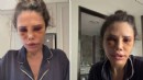 Didem Ceran estetik ameliyatını anlattı