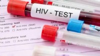 İzmir’de ücretsiz ve anonim test merkezi 2'ye çıktı