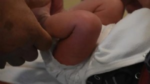 Sünnet edilen 27 günlük bebek öldü