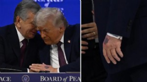 Trump'ın elindeki morluğun nedeni belli oldu